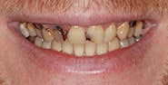 Before Image: Case 229 - front