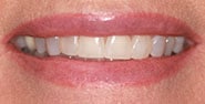 Before Image: Case 230 - front