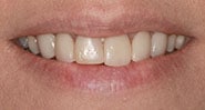 Before Image: Case 231 - front