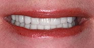 After Image: Case 234 - front