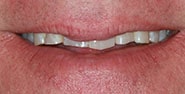 Before Image: Case 235 - front