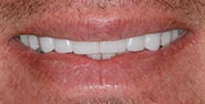 After Image: Case 237 - front