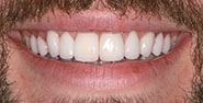 After Image: Case 239 - front