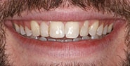 Before Image: Case 239 - front