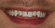 Before Image: Case 24 - front