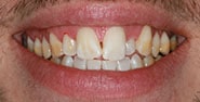 Before Image: Case 240 - front