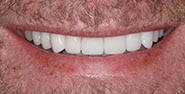 After Image: Case 241 - front