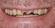 Before Image: Case 241 - front