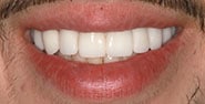 After Image: Case 243 - front