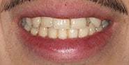 Before Image: Case 243 - front