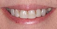 Before Image: Case 244 - front