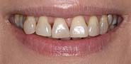 Before Image: Case 245 - front