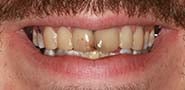 Before Image: Case 246 - front