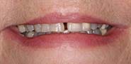 Before Image: Case 247 - front