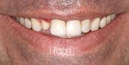 Before Image: Case 248 - front