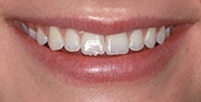 Before Image: Case 250 - front