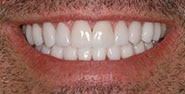 After Image: Case 251 - front