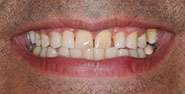 Before Image: Case 252 - front