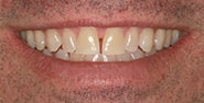 Before Image: Case 251 - front