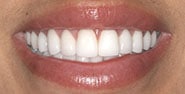 After Image: Case 253 - front