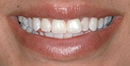 Before Image: Case 253 - front