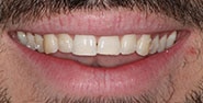 Before Image: Case 255 - front