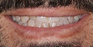 Before Image: Case 257 - front