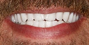After Image: Case 258 - front