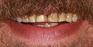 Before Image: Case 258 - front