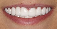 After Image: Case 259 - front