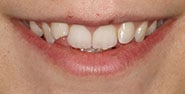 Before Image: Case 259 - front