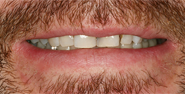 Before Image: Case 26 - front