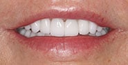 After Image: Case 263 - front