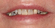 Before Image: Case 263 - front