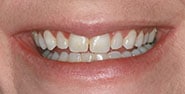 Before Image: Case 264 - front