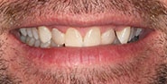 Before Image: Case 267 - front