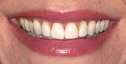 Before Image: Case 268 - front