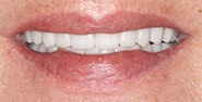 After Image: Case 269 - front