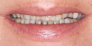 Before Image: Case 269 - front