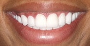 After Image: Case 270 - front