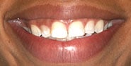 Before Image: Case 270 - front