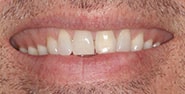 Before Image: Case 272 - front
