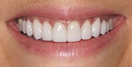 After Image: Case 273 - front