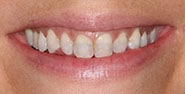 Before Image: Case 273 - front