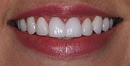 After Image: Case 274 - front