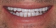 After Image: Case 277 - front