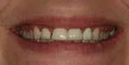 Before Image: Case 28 - front
