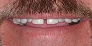 Before Image: Case 282 - front