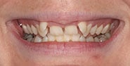 Before Image: Case 283 - front