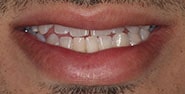 Before Image: Case 285 - front
